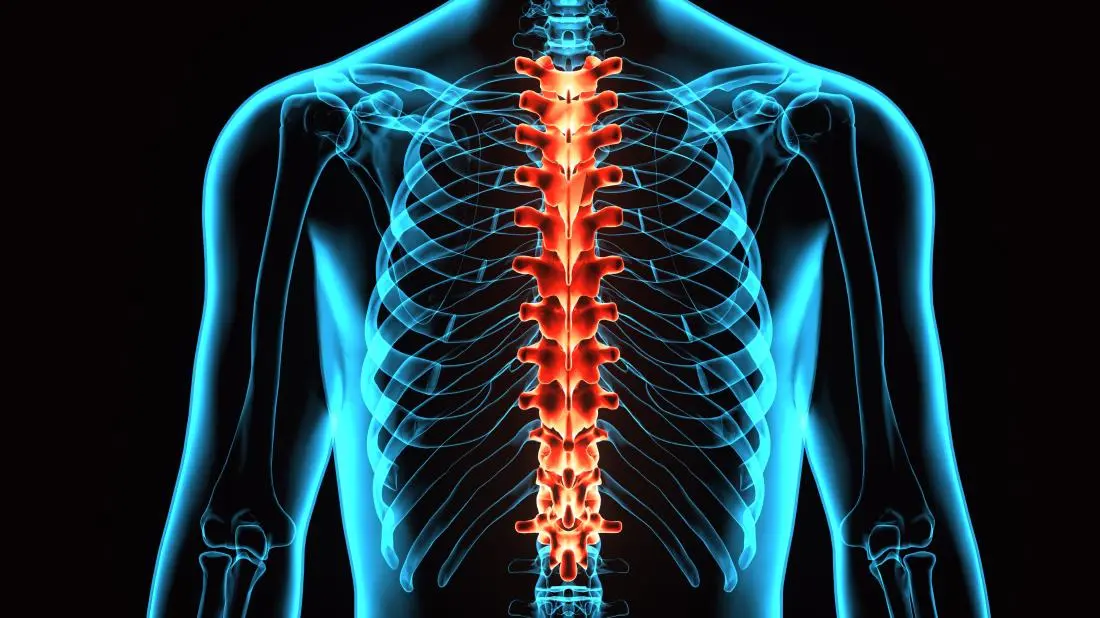 3D image of spine